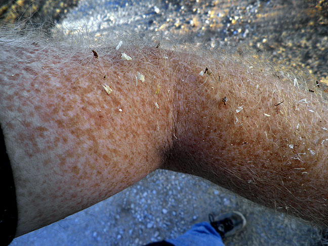 My arm hair is a surprisingly efficient trap for the sawdust created when cutting down bramble branches.